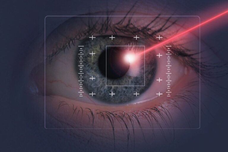 LASIK Eye Surgery in Pakistan (Lahore)